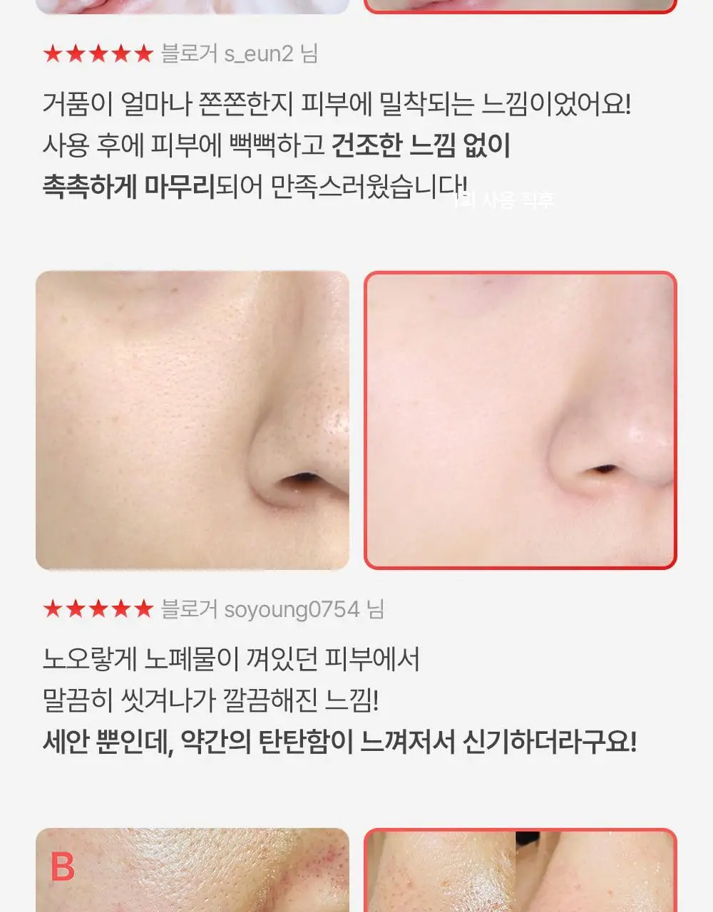 [모공쏙폼] 메디필 레드 락토 콜라겐 클리어 폼 2.0 대용량 300ml 기획 (+해면) 상세페이지 10